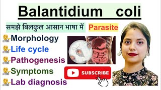 Balantidium coli in Hindi  Parasite  Morphology  Life Cycle  Symptoms  Hindi  Parasitology [upl. by Miksen]