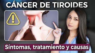 ¿Qué síntomas causa el CÁNCER DE TIROIDES y cuál es el TRATAMIENTO👩🏻‍⚕️ drapauzuniga [upl. by Allveta]