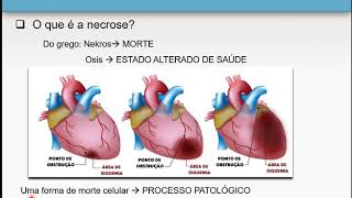 Necrose e apoptose 16  Patologia Geral [upl. by Enyrehtak191]