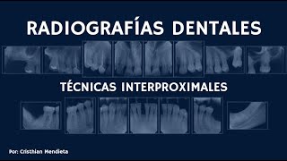 RADIOGRAFÍAS DENTALES  Técnicas Intraorales [upl. by Eelloh304]