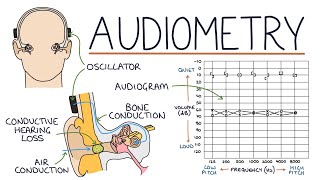 Understanding Audiometry and Audiograms [upl. by Illak]