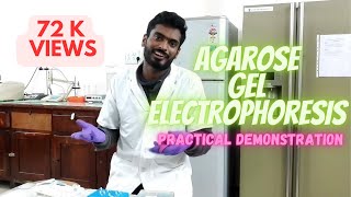 Agarose gel electrophoresis [upl. by Oitaroh]