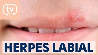 El herpes labial qué es causas y tratamiento [upl. by Amaerd]