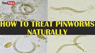 Pinworm threadworm lays eggs under Microscope no sound [upl. by Shadow]