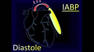 Intra aortic Balloon Pump Aortic Pressure Curve [upl. by Aniz859]