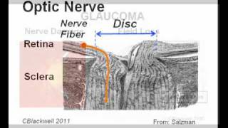 Eye Works 2 Image Retina Optic Nerve and Brain [upl. by Enyawal]