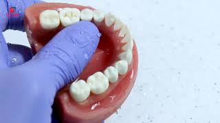 Class I simple occlusal cavity preparation short video [upl. by Assilam]