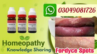 Fordyce spots  homeopathic treatments risk factors and symptoms explain by DrAbdul Manan [upl. by Loren]