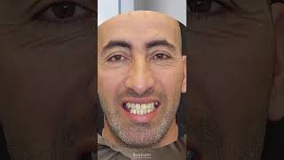 DENTISTE EN TURQUIE  🦷 Témoignage de Faouzi  3 implants dentaires  24 couronnes Emax  BODYEXPERT [upl. by Peregrine]