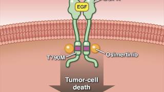 Osimertinib in Advanced Non–SmallCell Lung Cancer [upl. by Ansilme119]