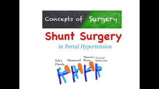 Shunt Surgeries in Portal Hypertension [upl. by Eceinwahs]