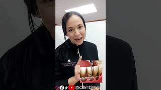 Limpieza dental o Curetaje periodontal❓😉 quito ecuador shorts tips youtubeshorts [upl. by Markiv]