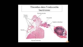 cours anapath pathologie circulatoire par pr guermi [upl. by Atinrev]