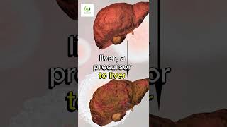 ALCOHOL vs LIVER The Shocking Truth you Need to Know [upl. by Yllen]