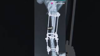 Biomaterials part 1 materialsscience biomaterials materialsengineering [upl. by Nnyleuqcaj]