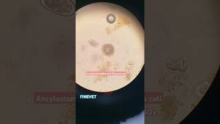 Ancylostomatidae and Toxocara cati hookworm roundworm cat microscope lab ancylostoma toxocara [upl. by Nwahsaj]