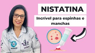 CONHEÇA NISTATINA POMADA para que serve como usar preço [upl. by Nuahsel]