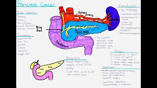 Understanding Pancreas Cancer  Risk factors Symptoms Diagnosis Treatment Classification [upl. by Kirt]