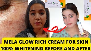 I tried Melaglow Rich Magical Skin Whitening Cream Shocking Results Pigmentation Spots Removal [upl. by Nogem]