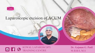 Laparoscopic excision of ACUM Kewal Hospital  Laparoscopy Training [upl. by Ahsenot425]