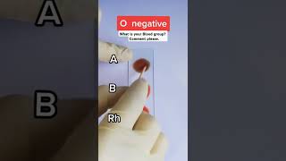 Onegative Blood group testshorts laboratory science [upl. by Aislehc494]