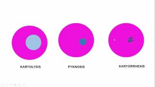 MORPHOLOGY OF CELL INJURY REVERSIBLE amp IRREVERSIBLE Necrosis amp its types [upl. by Khalsa]