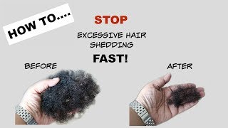 STOP Excessive Hair Shedding Fast  Tea Rinse  Natural Hair [upl. by Meehyrb593]