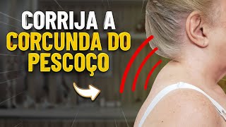 OS 3 MELHORES EXERCÍCIOS PARA A CORCUNDA DO PESCOÇO  FISIOPREV [upl. by Ielerol]