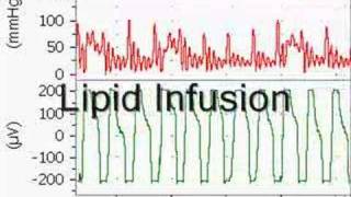 Bupivacaine Cardiotoxicity in an Anesthetized Rat [upl. by Cindy]