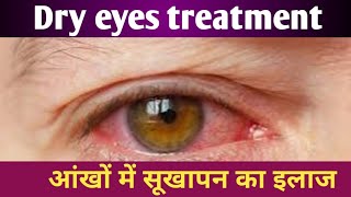 cmc eye drop used in hindi  tears top eye drop used in hindi  Tear Drops Eye Drops Uses in Hindi [upl. by Lindholm]