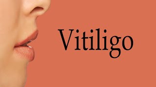 How To Say Vitiligo [upl. by Pytlik]