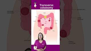 Different types of ostomies SHORT  LevelUpRN [upl. by Aseral]