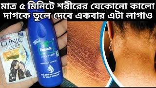 নারকোল তেলের সাথে শ্যাম্পু মিশিয়ে লাগাওমুখের কালো দাগ দূর করার উপায়ফর্সা হওয়ার সহজ উপায় [upl. by Ahern]