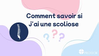 Scolioeye  Comment savoir si jai une scoliose [upl. by Dallas741]