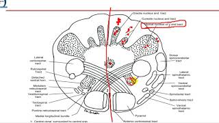 4 Closed medulla  motor decussation [upl. by Lenard]