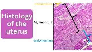 Histology of the uterus  Perimetrium Myometrium and Endometrium [upl. by Knipe]