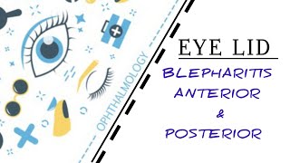 EYELID LECTURE4 ANTERIOR amp POSTERIOR BLEPHARITIS [upl. by Walley]