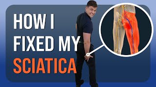 How I Healed My Sciatica Personal Recovery Story [upl. by Edlin]