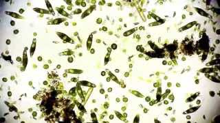 Mikroorganismen  microorganisms  Leben im Teich  life microcosmos 1080p Full HD [upl. by Syah424]