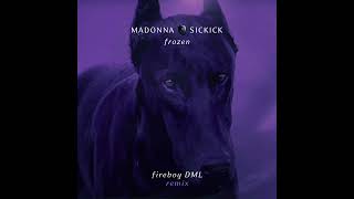 Madonna Vs Sickick  Frozen Fireboy DML Remix [upl. by Dessma]