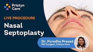 Deviated Septum Surgery  Endoscopic Septoplasty Explained  Pristyn Care [upl. by Dionis]