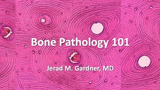 Bone Tumor Pathology 101 Osteosarcoma Chondrosarcoma and Mimics [upl. by Duma]