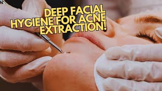 Deep Facial Extraction For Clear Skin  Blackheads Milia and Acne Treatment [upl. by Annamarie]