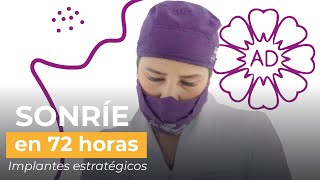 Sonríe en 72 horas con Implantes Estratégicos [upl. by Vod]