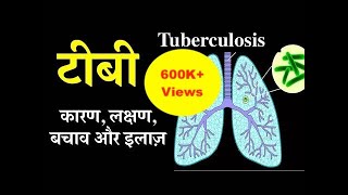 Tuberculosis causes symptoms treatment amp prevention in Hindi  टीबी के कारण लक्षण बचाव और इलाज़ [upl. by Aramoix830]