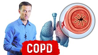 Chronic Obstructive Pulmonary Disease COPD [upl. by Llet488]