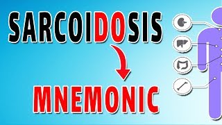 Sarcoidosis Symptoms Treatment and Causes [upl. by Duma]