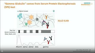 Evaluating Monoclonal Gammopathy of Undetermiend Significance MGUS with Free Light Chain Assays [upl. by Aicnatsnoc]