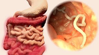 Nematode Navigations A Dive into Gastrointestinal Parasites 4 Minutes [upl. by Holub]