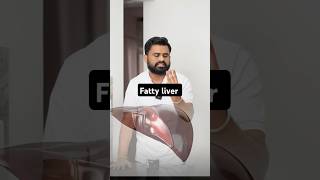 Fatty liver घर के खाने की ताकत को पहचानो drrobin health food ayurved doctor facts remedy [upl. by Kipp]